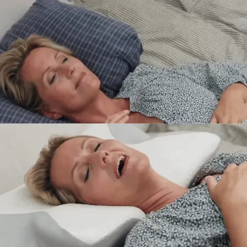 Przed i po z OrthoSleep